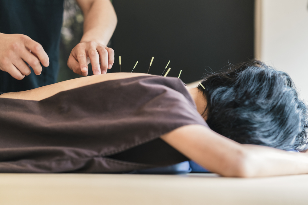 Traditional Chinese Medicine, acupuncture near me, AcuHerbal Wellness Center, acupuncture Naples, FL, Ft. Myers, FL, Allergy Relief
